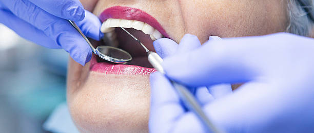 Best Emergency Tooth Extraction in Newton, IA